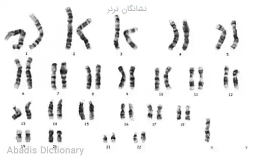 نشانگان ترنر